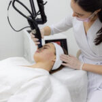 Лазерная шлифовка рубцов при постакне