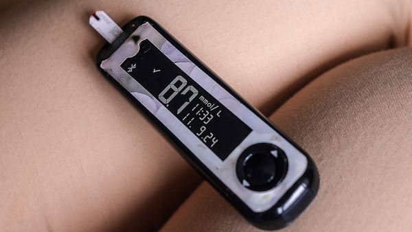 Ученые рассказали о взаимосвязи между диабетом и зубами